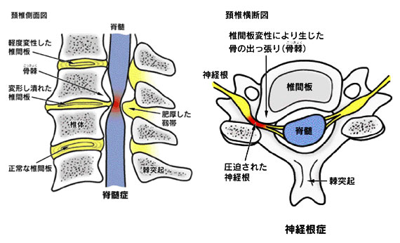 図3(日本整形外科学会のパンフレットより)