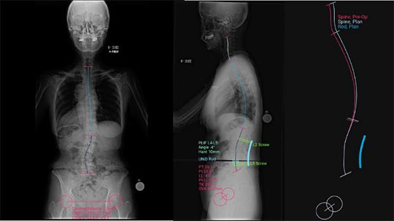 【図２】 UNiD TM ASIによるプランニング